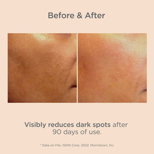 Isdinceutics Melaclear Dark Spot Correcting Serum for Face - Sun Spot Reducer that Contains Vitamin C and Antioxidants, to Even Skin Tone from Sun Exposure 0.5 FL OZ