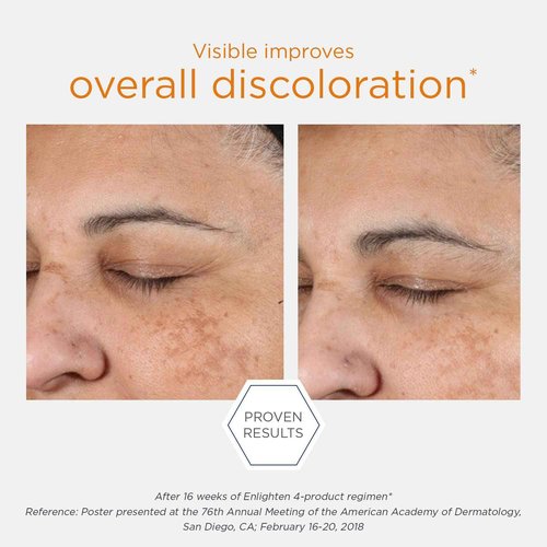 NEOSTRATA Illuminating Serum Tone Correcting Concentrate with NeoGlucosamine Niacinamide and Licorice Extract, 1 fl. oz.