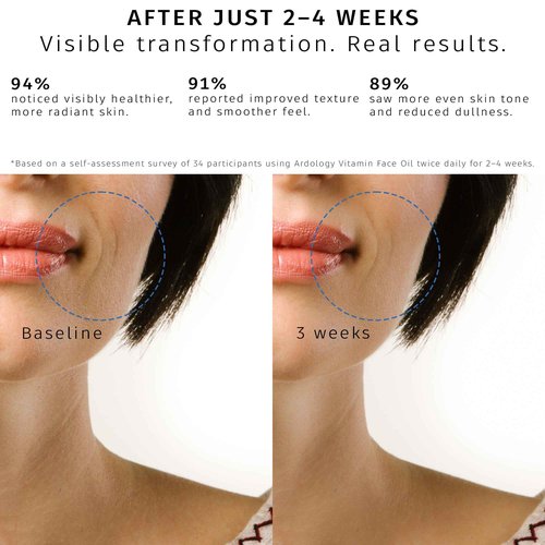 Ardology Vitamin ACE Hydrating Face Oil – Nourishes, Repairs & Protects Skin