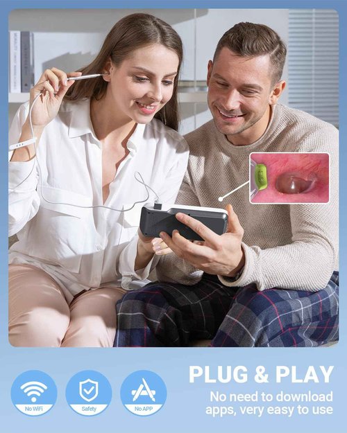 ScopeAround Otoscope Ear Camera with 4.5" IPS Screen, FHD Digital Otoscope with Gyroscope, FSA HSA Eligible Item, 32GB Card Ear Scope Otoscope with Light, Ear Wax Removal Tool Camera, Home Ear Checker