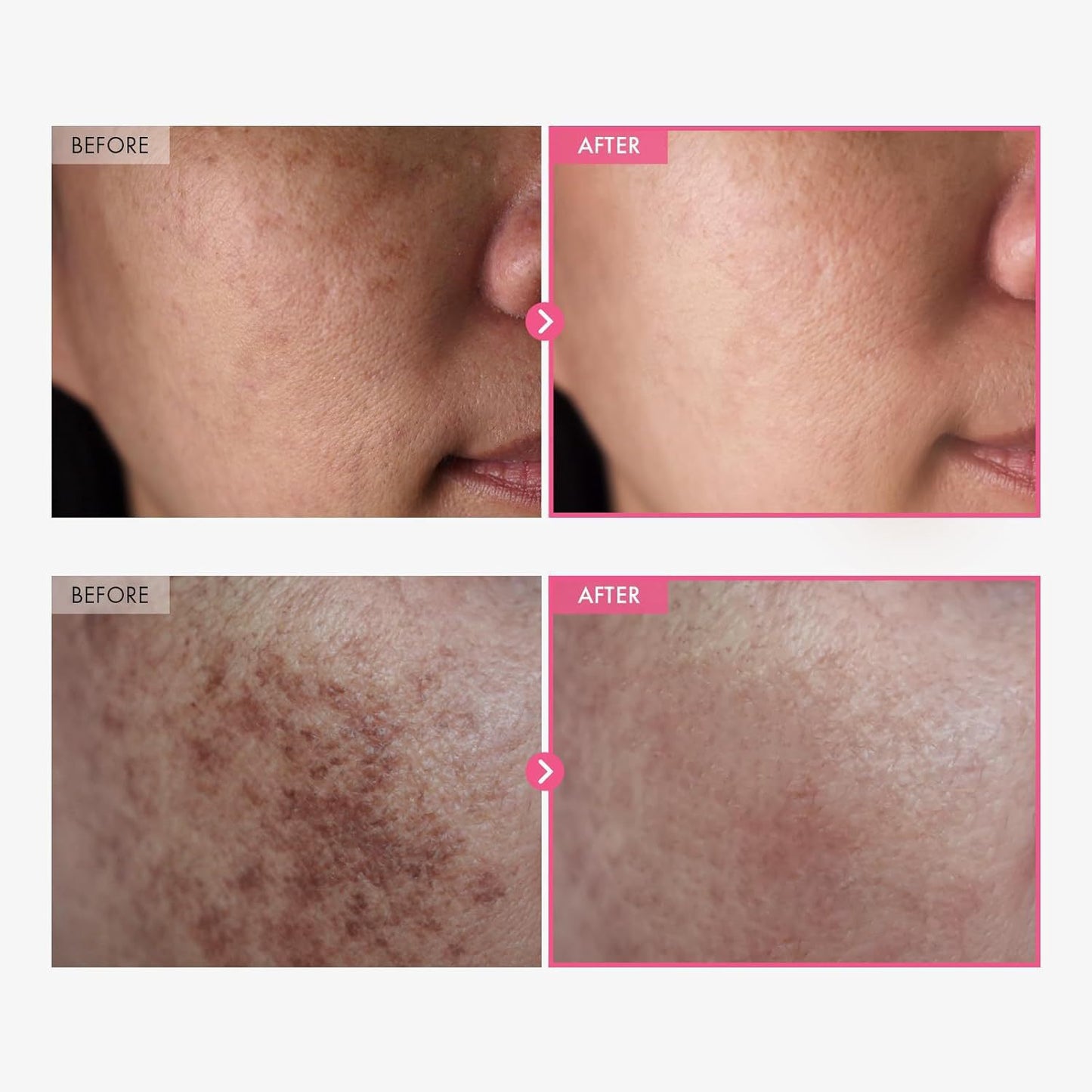 Collagen Face Cream with Hyaluronic Acid & Peptides - Brightening & Moisturizing 50ml