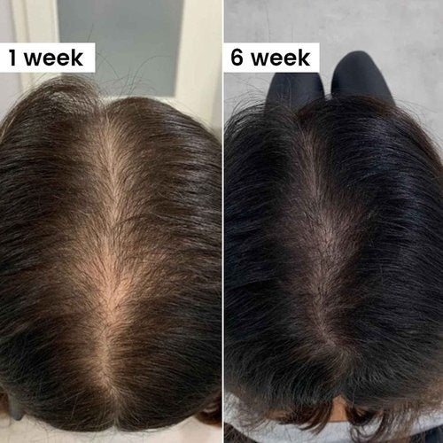 Thicair Hair Regrowth System - Volumizing Treatment with Copper Peptides & Collagen | Knotweed + Ginseng Root Extract | Supports Fuller, Healthier Looking Hair for Men & Women