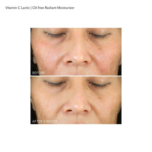 Dr Dennis Gross Vitamin C Lactic Oil-Free Radiant Moisturizer: For Dullness, Uneven Tone & Texture, Fine Lines and Occasional Dryness, 1.7 oz