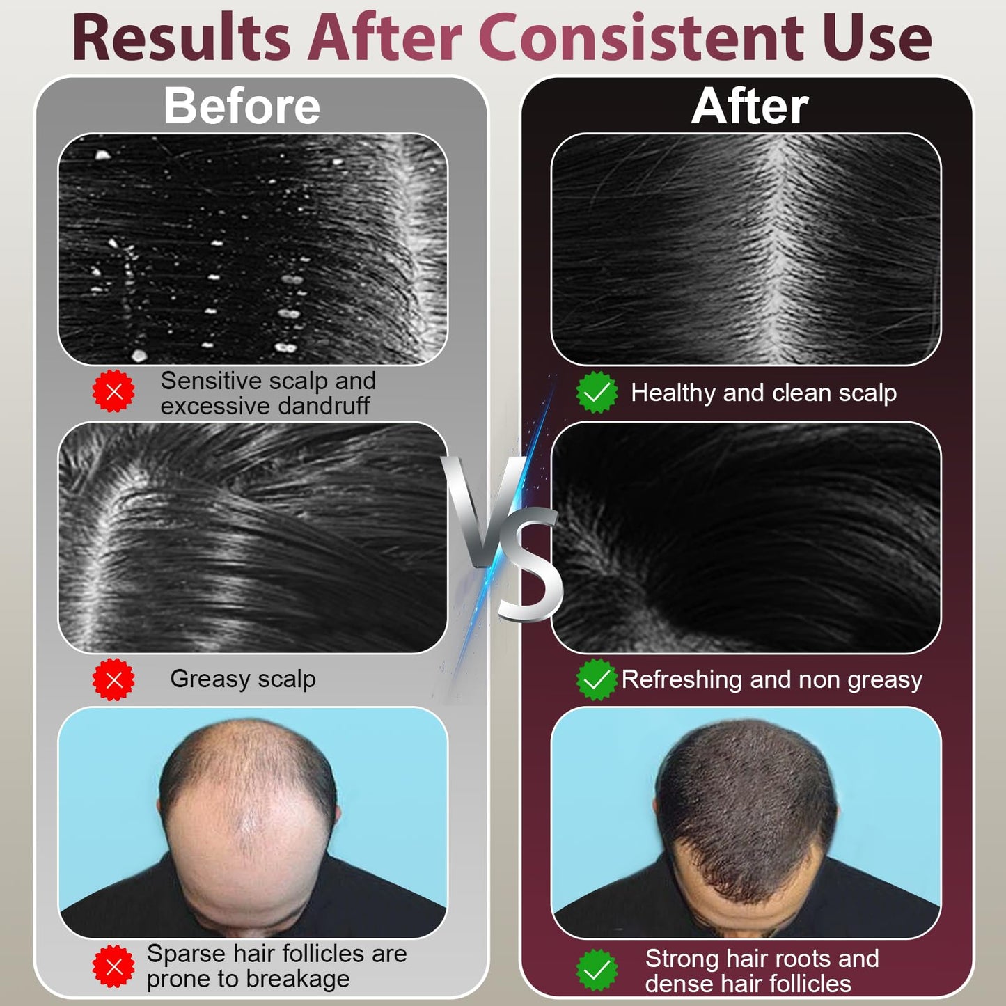 Laser Therapy Hair Growth Comb, Hair Oil Applicator,Electric Scalp Massager Hair Growth with IPX7 Waterproof