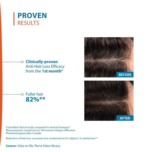 Ducray Creastim Reactiv Hair Loss Lotion 60 ml