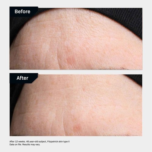 Revision Skincare Revox™ Line Relaxer, Targeted Under Eye Serum with Hyaluronic Acid, Improves Fine Lines and Wrinkles, 0.25 oz