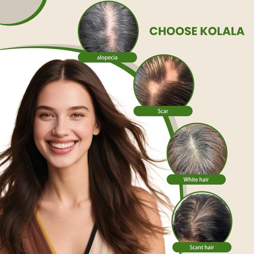 kolala HAIR Toppers for Women Real Human Hair 150 Density 12 inch 55 grams 6x7 inch Caramel Blonde Highlighted Blonde lace Silk Base Clip in Hair Pieces for Women（#18P60 12inch）