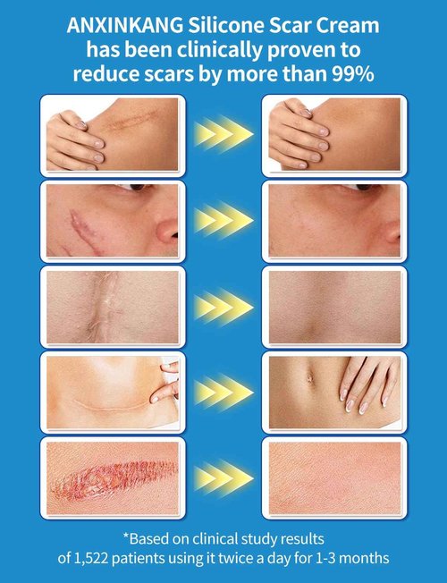 Silicone Scar Gel, Advanced Scar Cream treating for New and Old Scars, Surgical Scars, Burn Scars, Stretch Marks, Acne Scars, Dark markings, Keloid Removal 0.70 oz (20 g)