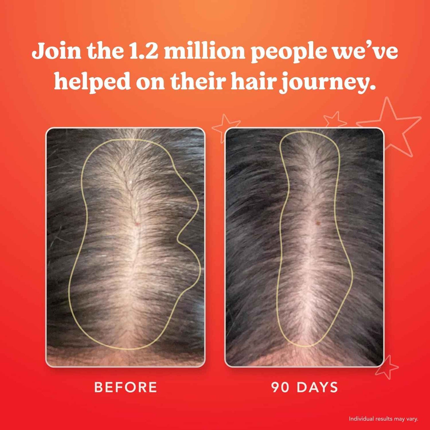 HAIRtamin Advanced Formula Hair Growth Supplement for Women & Men, Supports Stronger, Longer, Visibly Thicker Hair, With 5000 mcg Biotin, Vitamins & Antioxidants, 100% Vegan – 3 Month Supply