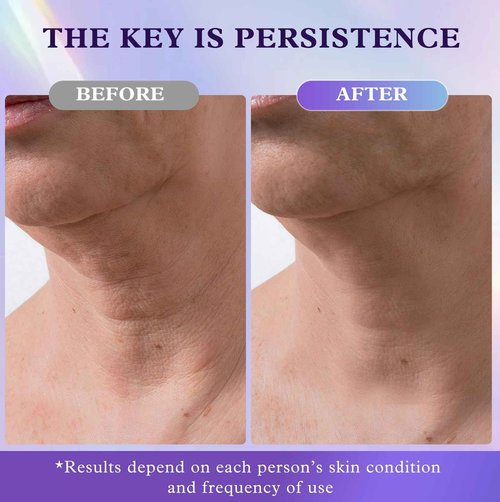 UKVOA Retinol Neck & Face Wrinkle Cream for Women, Neck Cream for Tightening and Firming, Anti Aging Skin Care with Collagen & Hyaluronic Acid, Instant Face Lift Cream 2-Pack
