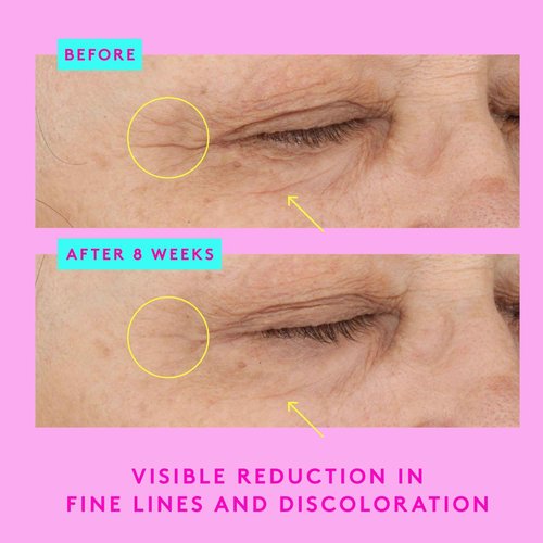 Drunk Elephant A-Shaba Complex Eye Serum - 15 ml/.5 fl oz - .1% Retinol Eye Cream - Clean Clinical Skincare - Cruelty-Free - Dermatologist-Tested - Free of Essential Oils, Silicones, and Fragrance