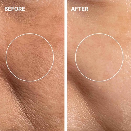 THOME Glow Sealer Mask Refill | Ultra-Hydrating Sheets for Skin Cycling & At-Home Treatment (6 Sheets)