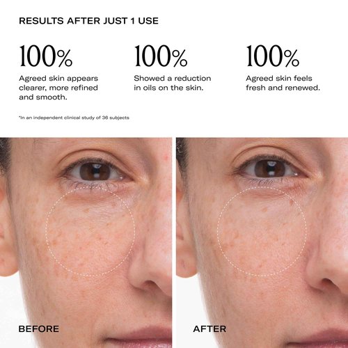 Le Prunier Plumtox™ Clarifying Enzyme Mask