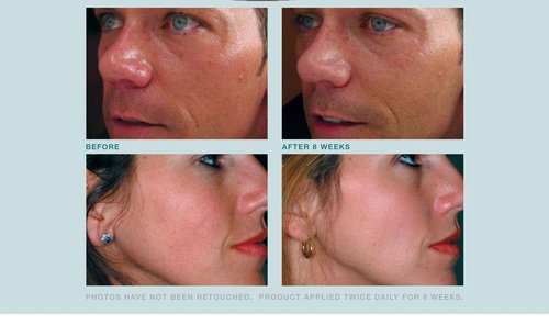 Tutta La Pelle Anti Aging face Cream TRIPLE Antioxidant Treatment Serum For Face, Resveratrol + Green Tea + Caffeine - Visibly Reduce Skin Redness & Calm Irritation -For Sensitive Rosacea Skin -1oz