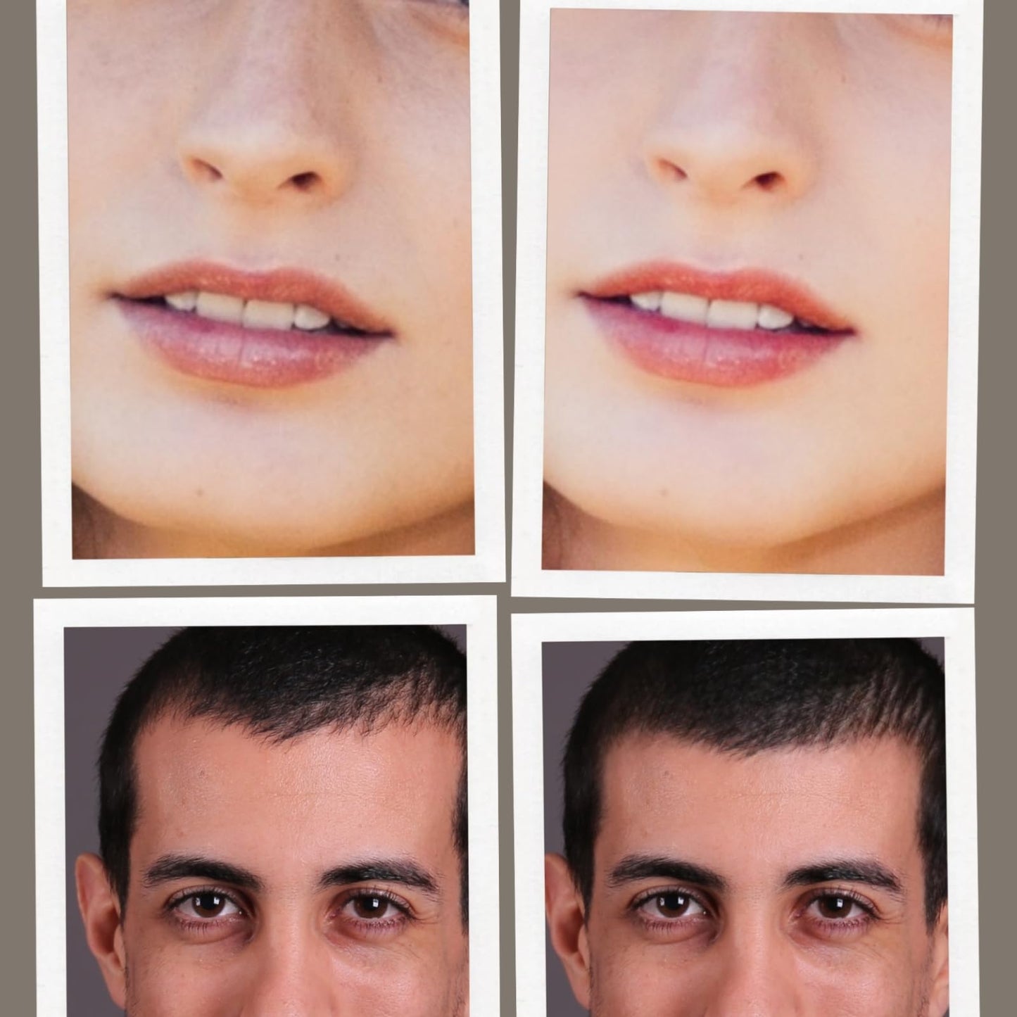 0.25mm Home Use Microneedle Derma Roller Pen, Derma Pen for Women Men - Microneedling Skin Care Beauty Kit Tool for Face Hair Beard