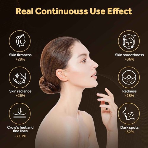 Sunegg Red Light Therapy for Face,LED Face Mask Light Therapy,Portable red Light Therapy mask for Home and Travel Skin Care