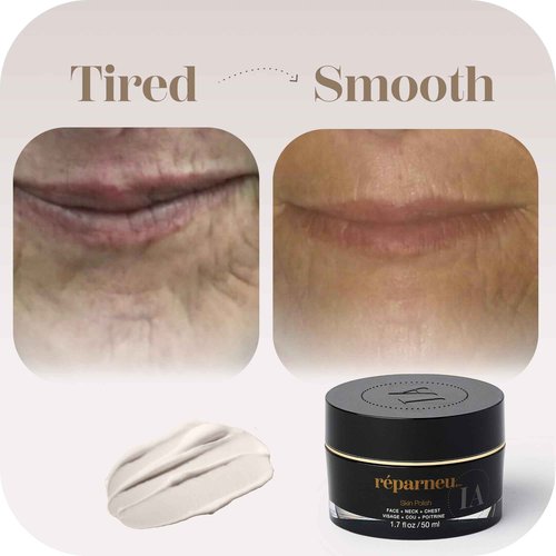 InfiniteAloe réparneu Skin Polish, Face Neck and Chest Microdermabrasion Polish for Rejuvenated Facial Skin - 1.7oz