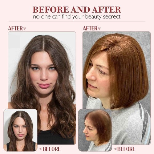 S-noilite Hair Toppers for Women 100% Real Human Hair, 10x12 Upgrade Base Natural Black Remy HairToppers for Women with no Bangs 10inch 35g #Natural Black