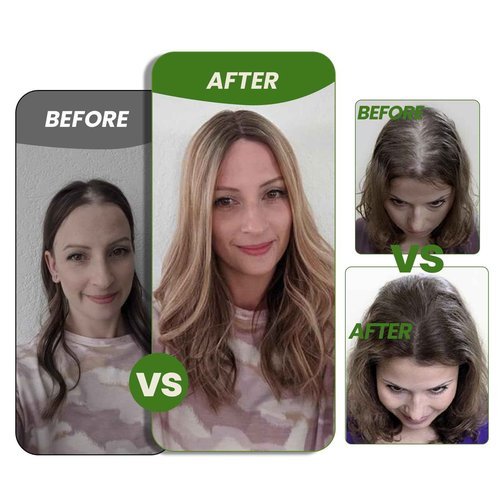 kolala HAIR Toppers for Women Real Human Hair 150 Density 12 inch 55 grams 6x7 inch Caramel Blonde Highlighted Blonde lace Silk Base Clip in Hair Pieces for Women（#18P60 12inch）