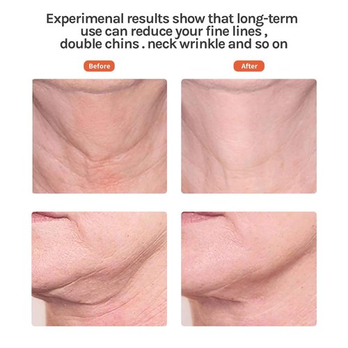 Red Light Facial Massager, Skin Care Tools for Face & Neck Beauty Device, 3 in 1 Face Massager Tool with LED, Thermal, Vibration, Tightenings, Rejuvenation for Women