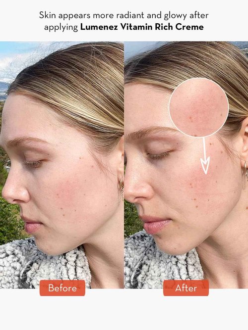 SONAGE Lumenez Vitamin Facial Cream: Daily Restorative Moisturizer with Vitamin C | Hydrating Cream for Dry Skin