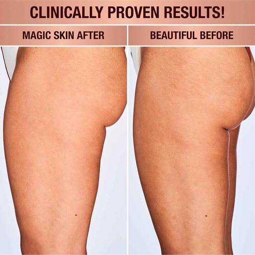 Charlotte Tilbury Magic Body Cream - Skin Tightening Cream for Body Enriched with Caffeine, Hyaluronic Acid & Shea Butter - Nourishes, Smooths & Hydrates Skin (200ml)