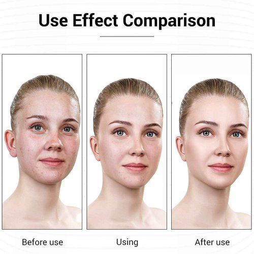 L E D Face Mask Light Therapy, 7 Colors L E D Light Therapy Mask, Red & Blue Light Therapy for Face, Light Mask for Skin Care, Portable Rechargeable