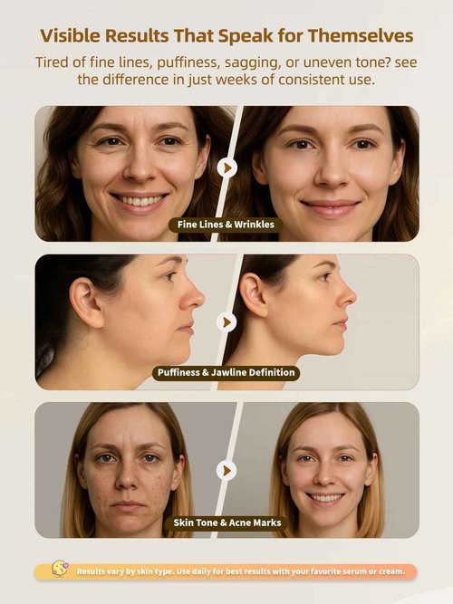 Yuonry 6-in-1 Age-Defying - Eye, Face & Neck Lift & Firm, 5-Color Light Therapy for Face with Microcurrent, Vibration, Heat & Cooling, Skin Care Tool for Youthful & Tightening Skin