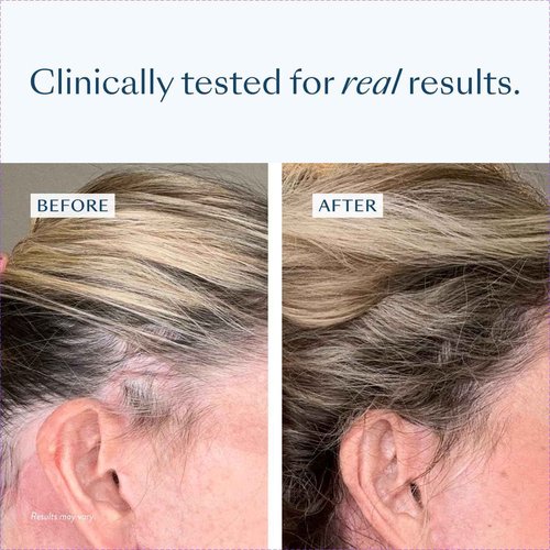eSalon Hair Regrowth Treatment, 2% Minoxidil Topical Solution, 2.7 fl oz, One Month Supply, for Women