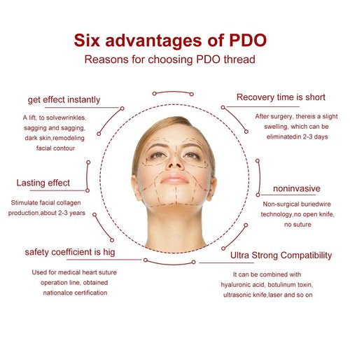 Minovd Pdo Threads for Eye Lift, Eye Lift Threads, Face Screw Threads, Blunt 30G25mm, 40Pcs, Smoothes Fine Lines Under the Eyes, Korea