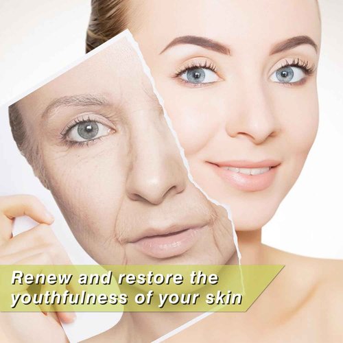 Elves Threads Lift for Face Whole Body Lifting/Screw Mono Threads for Eye lift/Protein Threads for Face/ 20pcs