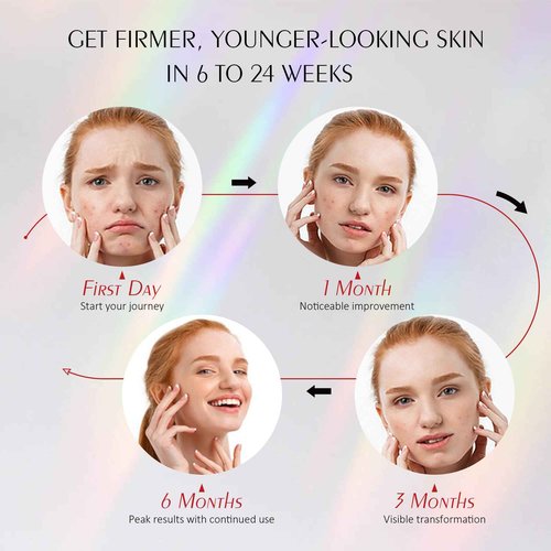Red Light Mask for Face, Silicone Soft LED Face Mask with Remote, 660nm & 850nm Red Light Mask with Timing Function, Reduced Wrinkles, Anti-Aging, at Home (White)