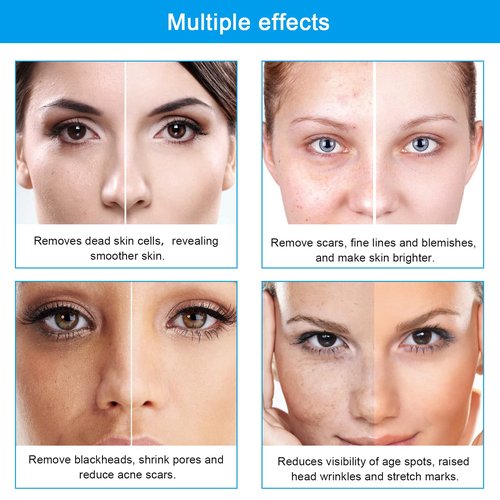 AIMENGXI Diamond Microdermabrasion Machine Professional Dermabrasion Machine Facial Care Salon Equipment for Vacuum Blackhead Removal