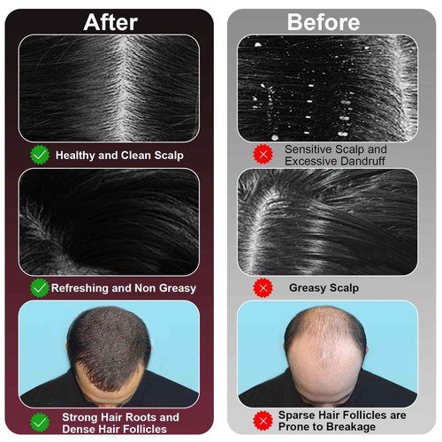 MERNUNUX Laser Therapy Hair Growth Comb, 3 in 1 Hair Oil Applicator for Hair Care, 360° Electric Scalp Massager, Stimulates Hair Regrowth for Men & Women, IPX7 Waterproof