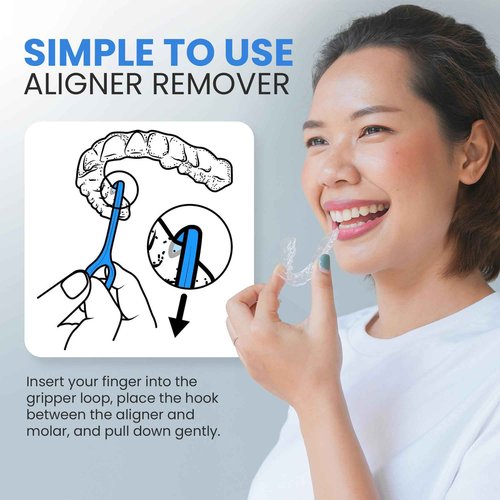 OrthoKey Clear Aligner Removal Tool - Unleash Precision: Grabber Remover for Braces & Retainers | Elevate Dental Care with Ortho Tools for Orthodontic Care | Small Blue, 30-Pack.