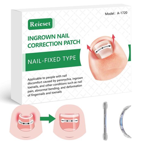 Reieset Titanium Alloy Ingrown Toenail Treatment, Nail Tools, and Ingrown Toenail Removal Kit Specially Designed for Curved Nail Repair and Ingrown Toenail Corrector (0.67/0.79in)