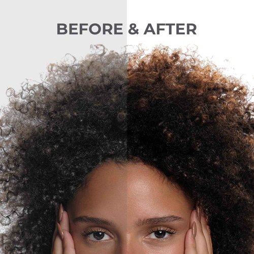 Capillus Synergy Kit, Conditioner, Shampoo, & Enrich Serum, Lock in Nutrients & Moisture while Promoting Healthy Hair Growth for Men & Women