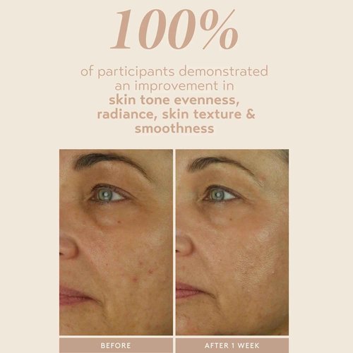 SHANI DARDEN SKIN CARE Retinol Reform with 1% Encapsulated Retinol Serum for Face & Neck, Gentle Slow-Release Face Serum with Tripeptide for Wrinkles, Fine Lines & Uneven Tone, 1 fl oz