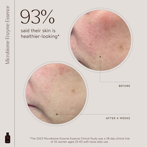 True Botanicals Microbiome Enzyme Essence | Hydrating & Resurfacing Benefits for All Skin Types | Gives a Dewy Looking Complexion | Dermatologist Tested, All Natural, Vegan | 4 fl oz | 118 ml