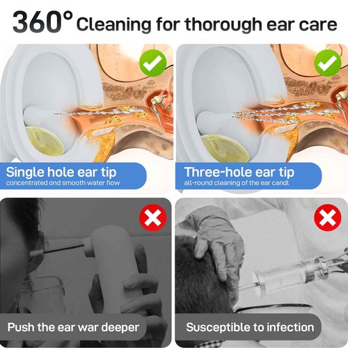 Electric Ear Wax Removal Kit, Ear Irrigation Flushing System with Dual Large Water Tank, 4 Pressure Mode, 2 Tips, Safe Water Ear Cleaner, Effective Ear Flushing Kit for Adults, Waterproof IPX6