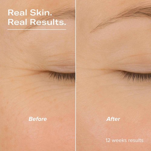 serum junkie SMOOTH Retinol and Peptide Serum with Encapsulated Retinol, Bakuchiol, Matrixyl 3000, Melatonin, Vitamin E, Anti-Aging, Targets Fine Lines, Uneven Texture, Dullness, 1 fl oz