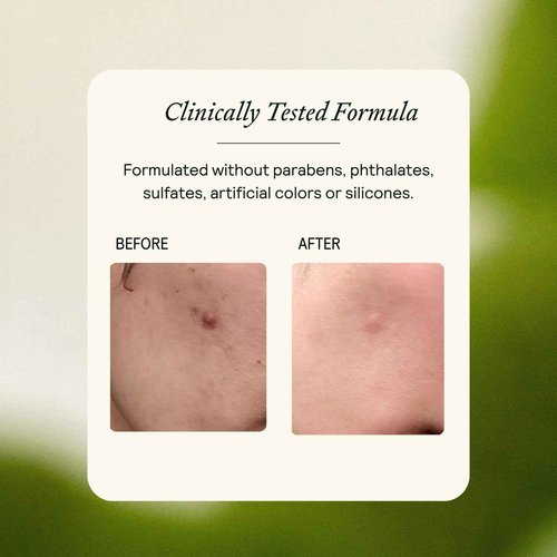 MARK Los Angeles - EQ Daily Moisturizer - EGCG + Quercetin - Hydrating Face Cream - For Dry Skin, Redness & Blemishes - With Jojoba & Squalene Oil - Lightweight Plant-Based Formula - 1.69 fl oz