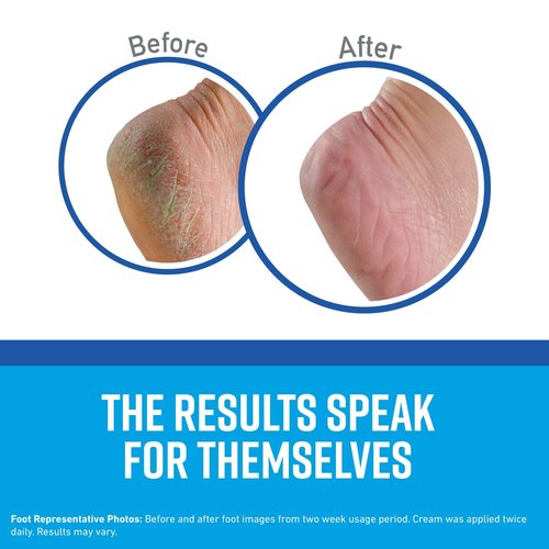 O'Keeffe's K0320001-7 Healthy Feet Foot Cream in Jar (7 Pack), 3.2 oz