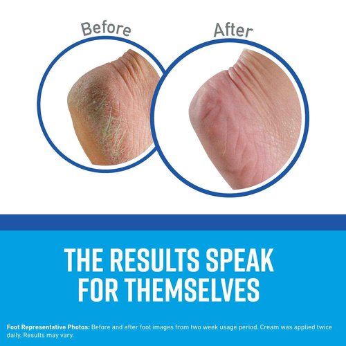 O'Keeffe's K0320001-8 Healthy Feet Foot Cream in Jar (8 Pack), 3.2 oz