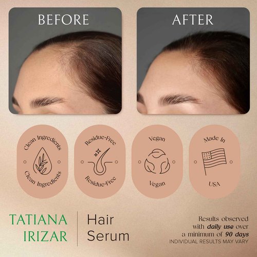 Hair Serum for Hair Growth Serum Women Made in USA - 2 Pack Scalp Serum for Hair Growth Non-Greasy Rosemary & Amla Hair Care Vegan 1 Oz Hair Loss Treatment for Women Regrowth Treatment