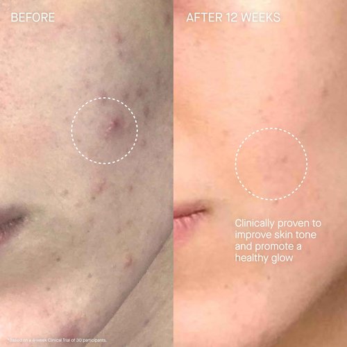 Augustinus Bader The Cream – Luxury Face Cream – Hydrating and Nourishing Face Moisturizer – Facial Moisturizer for Wrinkle Reduction and Cellular Renewal – For Men and Women – 0.5 fl oz