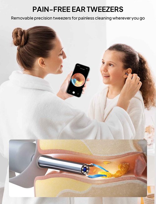 Ear Wax Removal Tool Camera with Light–Visual Ear Cleaner Otoscope Ear Scope, Flexible Wireless Ear Cleaning Kit Ear Picker, Portable Painless Earwax Remover Tweezers for Adults, Kids