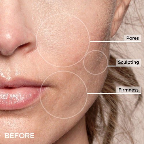 BeautyBio GloPRO Cryo Roller Duo: Skin Icing Attachment Head For Eyes, Face and Body. Sculpts, de-puffs, tightens pores and regulates oil