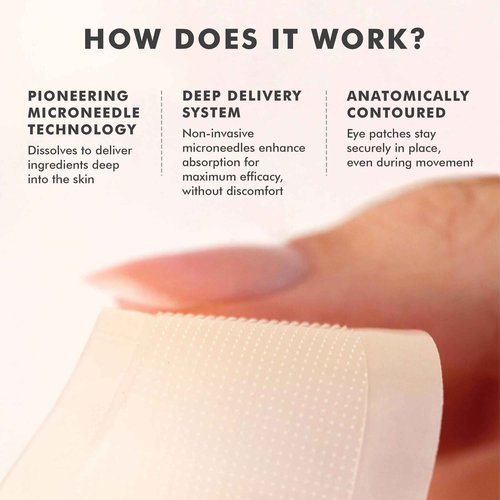 skyn ICELAND Dissolving Microneedle Under Eye Patches with 39% Hyaluronic Acid and Peptides, No Slip Overnight Eye Mask for Fine Lines, Wrinkles and Firming, Vegan, All Skin Types, 5 Pairs