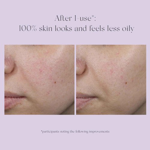 EXUVIANCE Performance Peel AP25 At-Home Chemical Peel with Glycolic, Mandelic and Polyhydroxy Acids, 13 ct.
